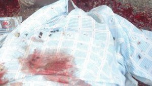 Detail of the body of Hassan Hurshe. (Morning Star News photo)