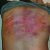 Marks of Armin Davoodi's interrogation by authorities in Iran. (Morning Star News)