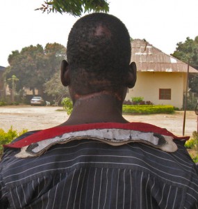 Boko Haram members cut the back of the neck of Adamu, a Christian in Gwoza, Borno state. (Morning Star News)