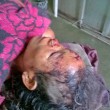 Nimai Rabha, beaten in attack in Assam state, India. (Morning Star News)