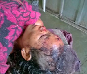 Nimai Rabha, beaten in attack in Assam state, India. (Morning Star News)