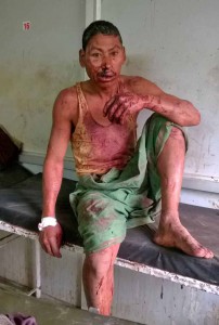 Unidentified victim of attack in Assam, India. (Morning Star News)