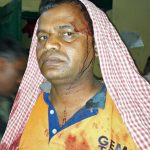 Pastor Sikhandar Kumar after assault in Jadhua, Bihar state. (Morning Star News courtesy of family)