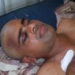 Pastor Banothu Sevya after attack by Hindu extremists in Telangana state, India. (Morning Star News courtesy of family)