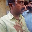 Hindu extremists wounded Pastor Karthik Chandran in Tamil Nadu state, India. (Morning Star News)
