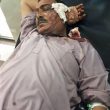 Injured member of King Jesus Church in Burewala, Punjab Province, Pakistan. (Morning Star News)