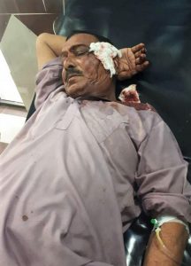 Injured member of King Jesus Church in Burewala, Punjab Province, Pakistan. (Morning Star News)