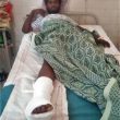 Kolhapuri Immanuel, 20, after surgery for broken foot bone. (Morning Star News)
