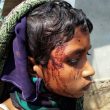 Mob beat Savita Madkami, 13, when she tried to rescue her mother. (Morning Star News)
