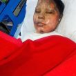 Asma Yaqoob succumbed to her injuries on Sunday night (April 22) after attack last week. (Morning Star News).