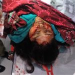 Body of Firdous Masih after attack in Quetta, Pakistan. (Morning Star News)