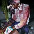 House church pastor Madira Koti Reddy was attacked with an axe. (Morning Star News)