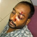 Vikram John was beaten by Muslim neighbors in Karachi, Pakistan. (Morning Star News)
