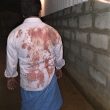 Christian attacked by Hindu extremists in Veppur village, Vellore District, on Sept. 13, 2018. (Morning Star News)