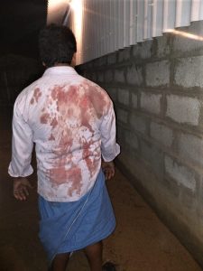 Christian attacked by Hindu extremists in Veppur village, Vellore District, on Sept. 13, 2018. (Morning Star News)