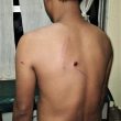 Christian injured in attack in Bongaigaon District, Assam state, India. (Morning Star News)