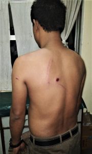 Christian injured in attack in Bongaigaon District, Assam state, India. (Morning Star News)
