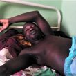 Samuel Wah in hospital in Miango, Nigeria, nearly three months after Muslim Fulani herdsmen shot him. (Morning Star News)