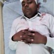 Hindu extremist attack in Chapar, Uttar Pradesh, India left Mukesh Kumar with head injuries. (Morning Star News)
