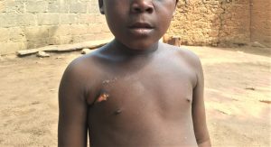Muslim Fulani herdsman shot 7-year-old Christian boy in Gwanje village, Nasarawa state, on May 3, 2019. (Morning Star News)