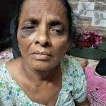 Sarla Mangala, 65, was among those assaulted in HIndu extremist attack in Sohna, Haryana state, India on Sept. 22, 2019. (Morning Star News)