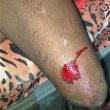 Injured leg of Shyama Prasad, father of pastor Sawan Pol in Bagwala village, Uttarakhand state, India. (Morning Star News)
