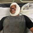 Church leader Isaac Paulose in hospital after attack in Sehore, Madhya Pradesh state, India. (Morning Star News)