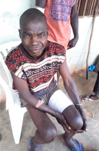 Abbayo Ki was wounded in attack by Muslim Fulani herdsmen in Ngbar Zongo village, Plateau state, Nigeria. (Morning Star News)