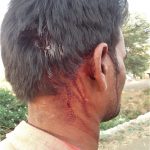 Pastor Lalu Kirade was attacked in Madhya Pradesh, India for filing police report on prior assault. (Morning Star News)