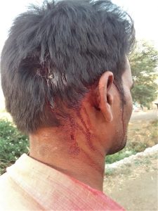 Pastor Lalu Kirade was attacked in Madhya Pradesh, India for filing police report on prior assault. (Morning Star News)