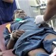 Ashiq Masih in hospital after police vehicle struck him in Gujranwala, Pakistan. (Morning Star News)