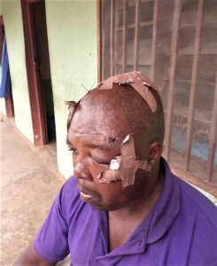 Yusuf Pam sustained cuts from machete attack by Muslim Fulani herdsmen on April 26, 2020 in Plateau state, Nigeria. (Morning Star News)