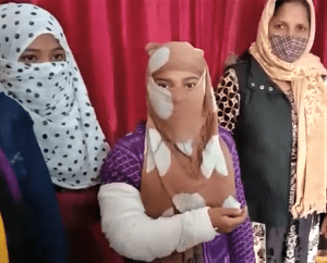 Hindu extremists broke the hand of Neha, 18, in an attack on her church in Shahjahanpur, Uttar Pradesh, India on Jan. 3, 2021. (Morning Star News)