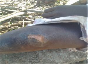 Knee injury of 10-year-old girl attacked in eastern Uganda on Jan. 24, 2021. (Morning Star News)