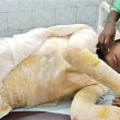 Attack in Bihar state, India left Nitish Kumar, 14, with burns on 65 percent of his body. (Morning Star News)