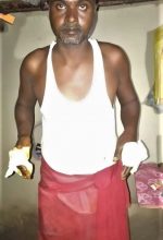 A Christian identified only as Sabajeet said police beat him in Sultanpur District, Uttar Pradesh. (Morning Star News)