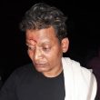 Pastor Rakesh Babu after attempt to kill him in Chandauli District, Uttar Pradesh, India on Jan. 14, 2022. (Morning Star News)