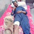 Waqas Masih is recovering after March 23, 2024 attack in Faisalabad District, Pakistan. (Christian Daily International-Morning Star News)