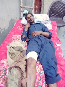 Waqas Masih is recovering after March 23, 2024 attack in Faisalabad District, Pakistan. (Christian Daily International-Morning Star News)