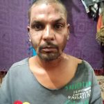 Zahid Morris suffered serious burns on his face and neck after a Muslim set fire to him on Jan. 21, 2026. (Christian Daily International-Morning Star News)