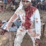 Sukra Madi was beaten for his faith on June 21, 2025 in Kotamateru village, Malkangiri District, Odisha state, India. (Manglu Madi for Morning Star News)
