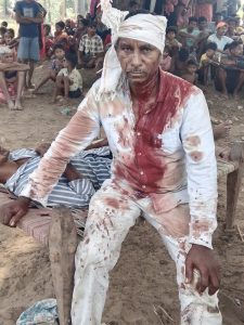 Sukra Madi was beaten for his faith on June 21, 2025 in Kotamateru village, Malkangiri District, Odisha state, India. (Manglu Madi for Morning Star News)