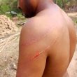 Pastor Motu Sodi was attacked with wooden sticks in Sukma District, Chhattisgarh state, India on April 13 and 14, 2026. (Morning Star News)